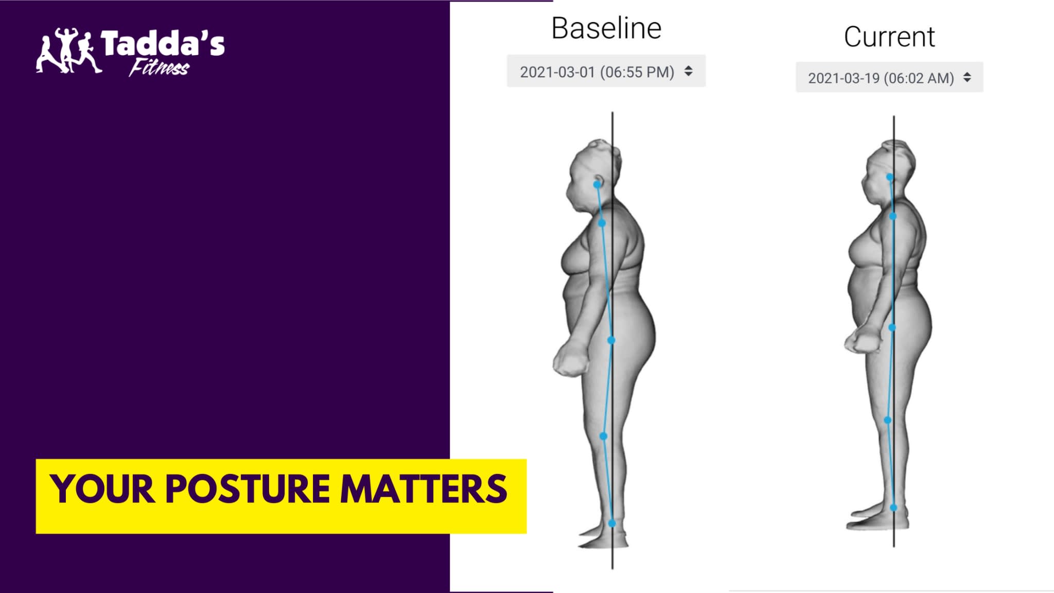 Our Posture Your Posture Matters
