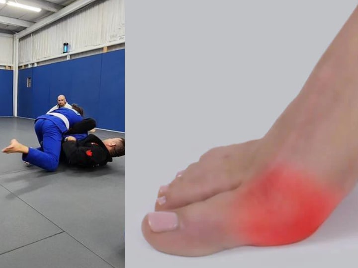 Turf toe in BJJ Brazilian Jiujitsu