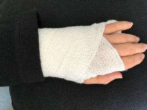 Learn This From My Injury