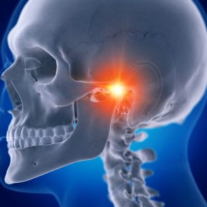 What is Temporomandibular Joint Disorder or TMD?