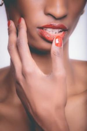 What are Canker Sores?