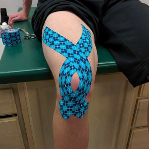 2 Reasons to get Kinesio-taped