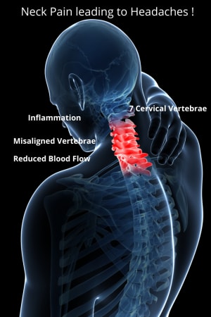 Headaches what is the Cause?