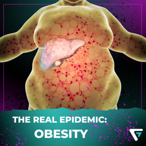 Why is the obesity epidemic accelerating?