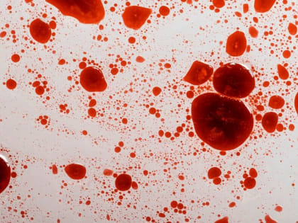 Конфликт на почве аренды: ковровчанин нанес тяжкие травмы другу