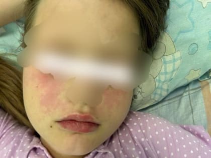 Владимирские врачи обнаружили у 10-летней девочки артрит
