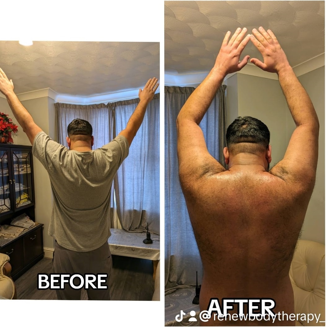 Before and after treatment comparison 1