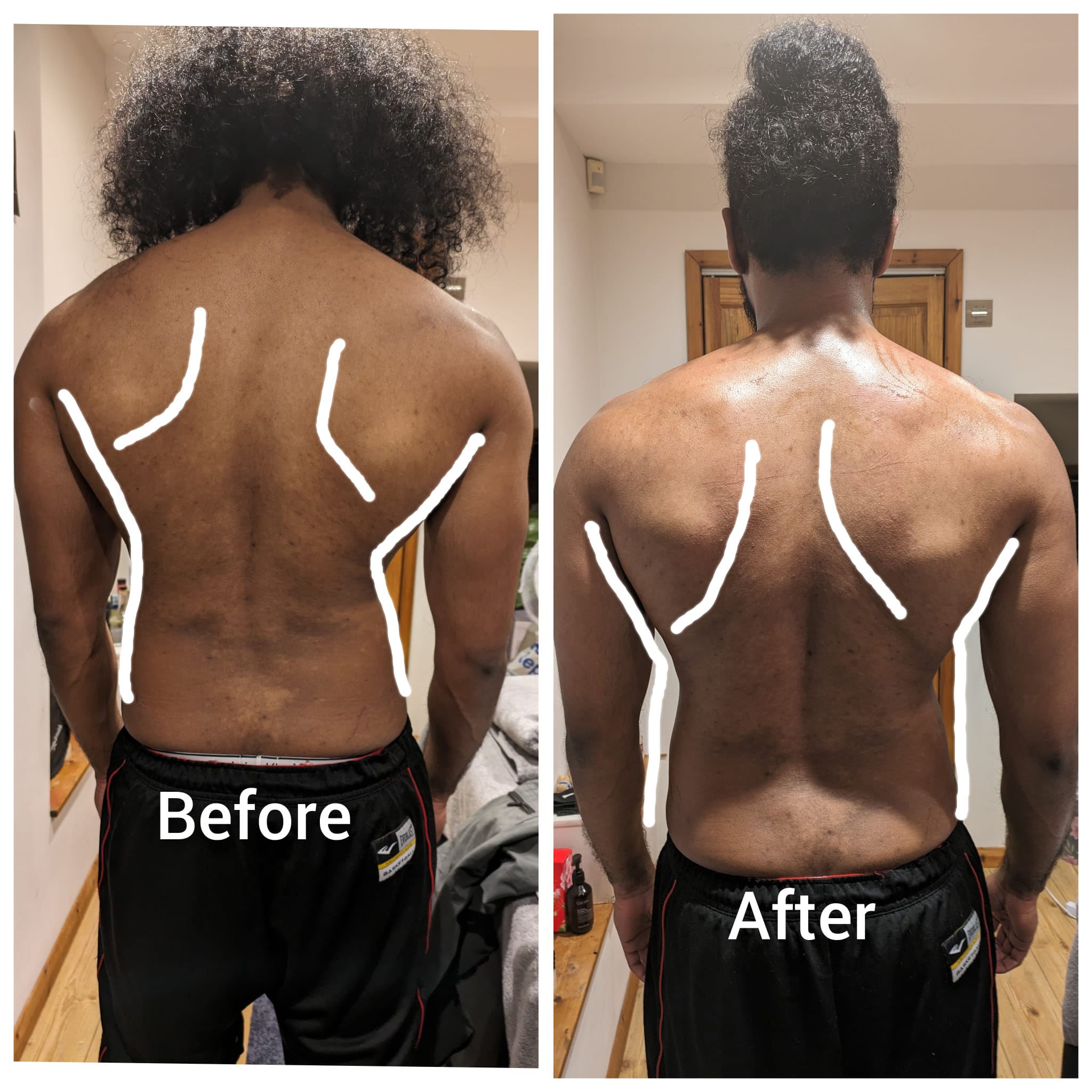 Before and after treatment comparison 2