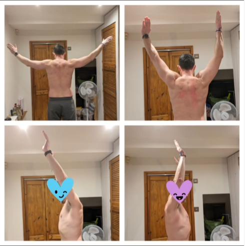 Range of motion improvement 2