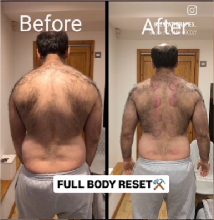 Client treatment results 8