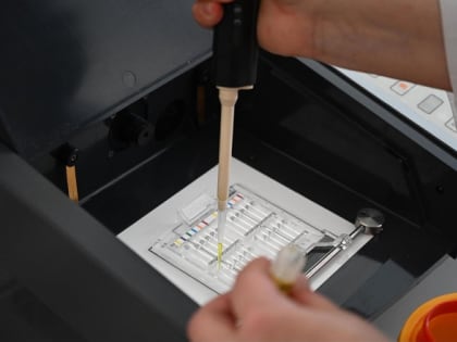 В Челябинске впервые с 2020 года выявили корь