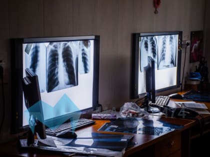 На Южном Урале за сутки COVID-19 заболели менее двухсот человек