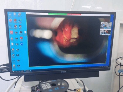 В Челябинском онкоцентре провели операцию в формате «живой хирургии»