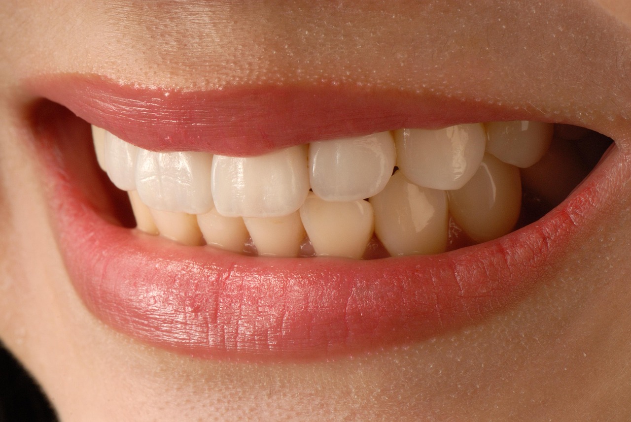 Why Veneers Are A Great Option For You
