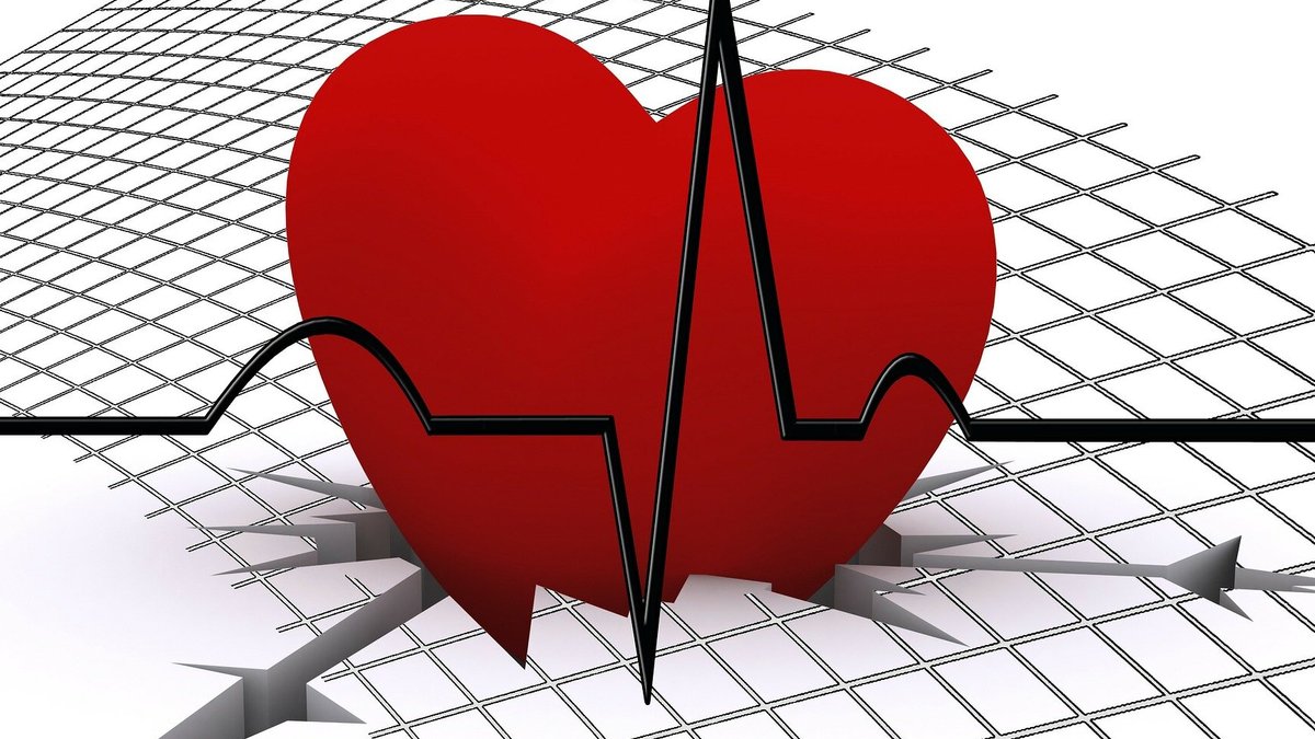 Avoidable inequalities persist in cardiovascular care disparities - cardiovascular disparities