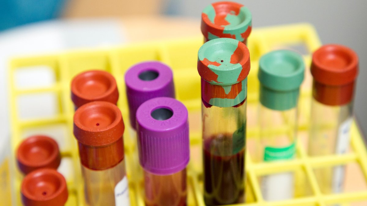 New marker identifies advanced prostate cancer patients for combo immunotherapy - prostate cancer immunotherapy