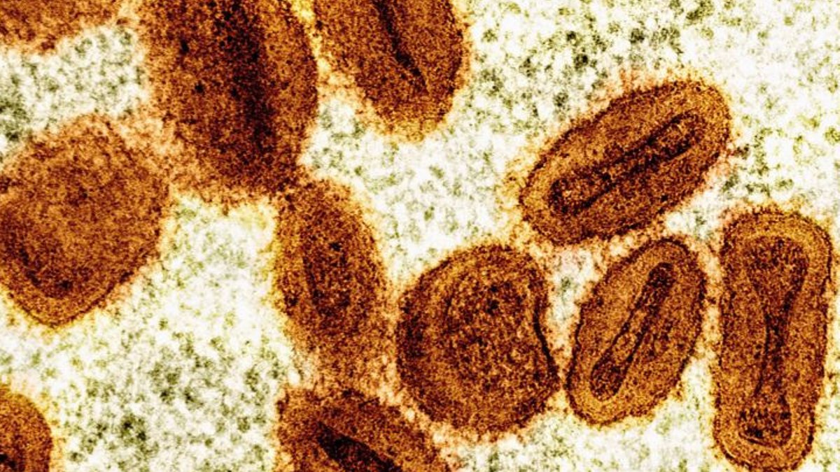 Scientists charged with mpox virus import lies