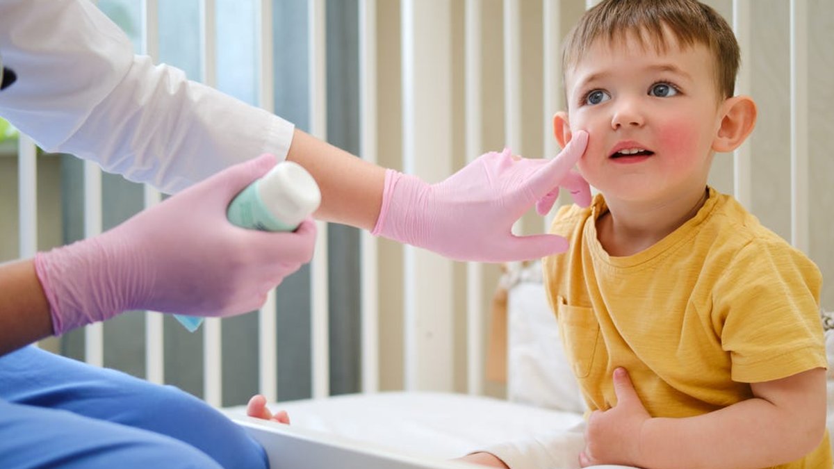 Eczema Treatment Options for Children Explored - eczema treatment