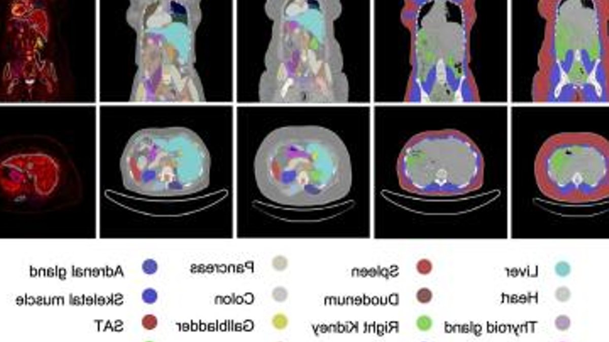 Bariatric surgery alters body metabolism study finds - bariatric surgery