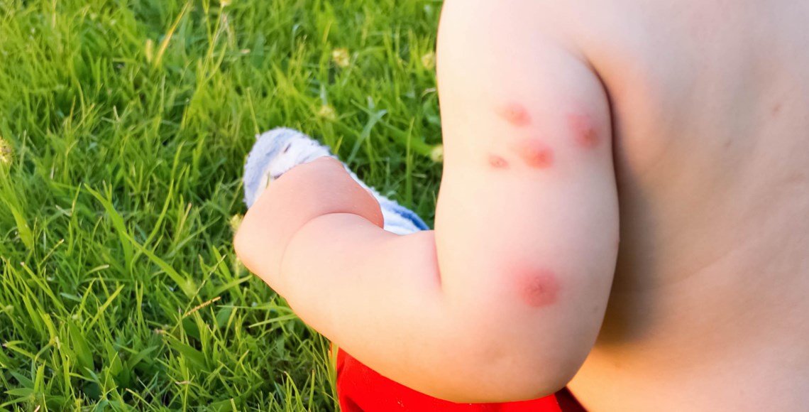 5 Mosquito Repellent Materials for Children to Sleep Quietly