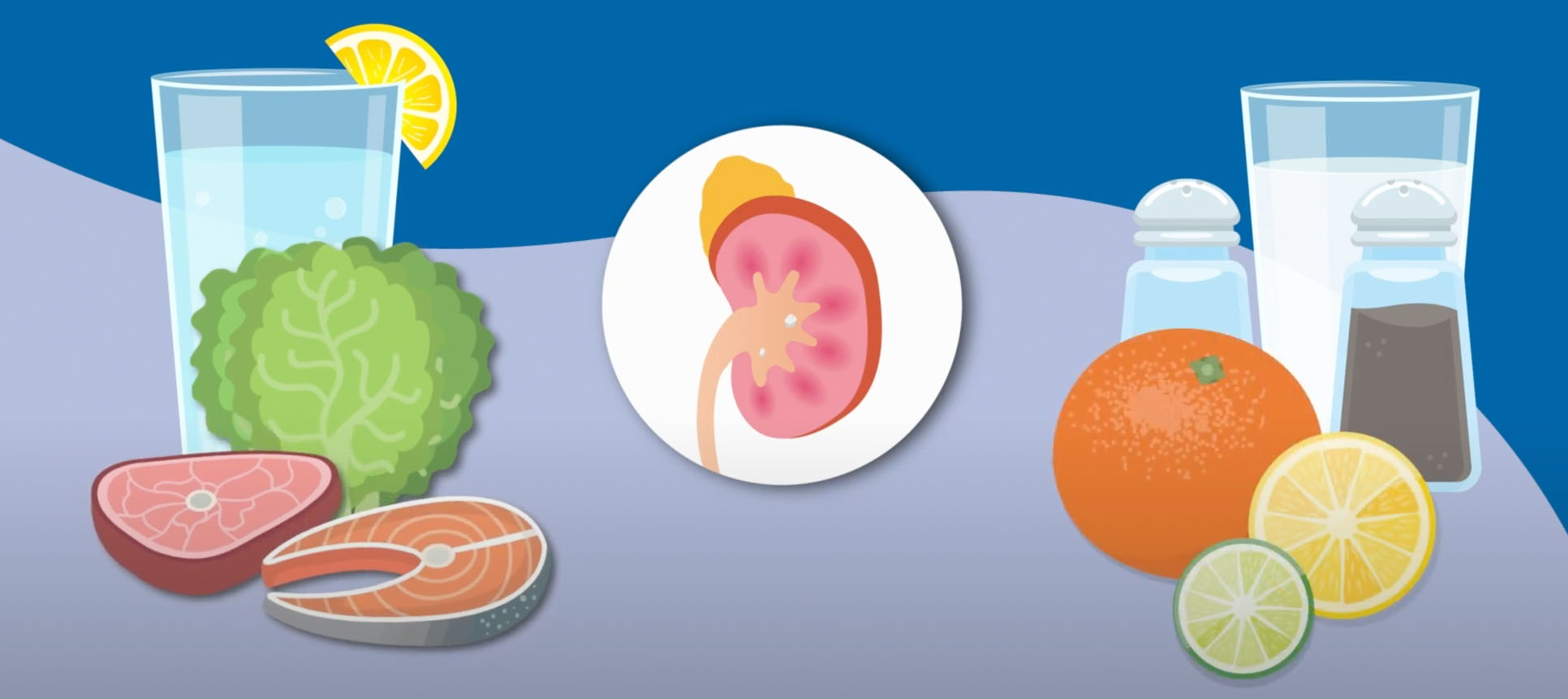Kidney Stone Prevention: A Guide