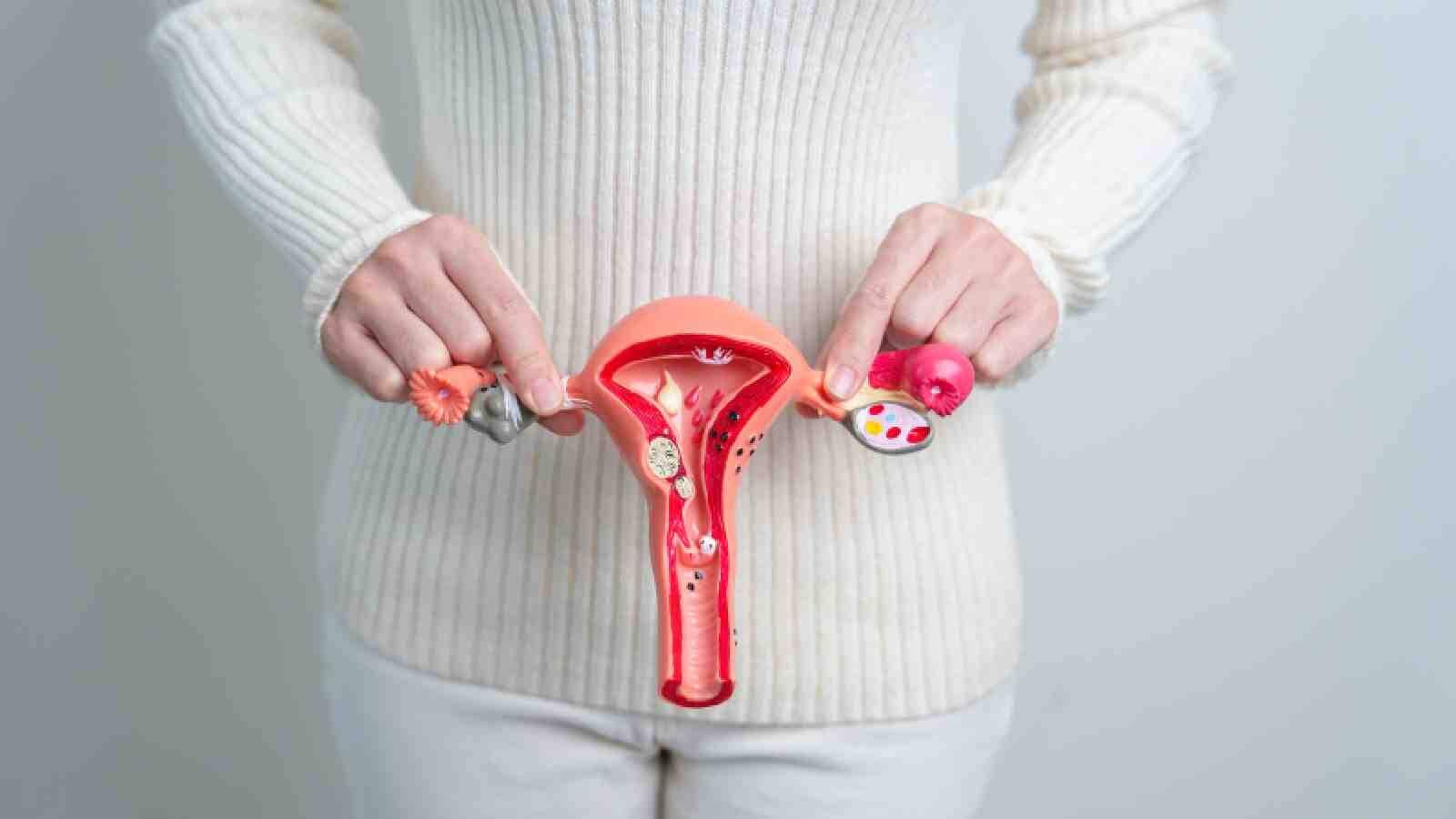 4 Common Uterine Fibroid Myths You Should Know
