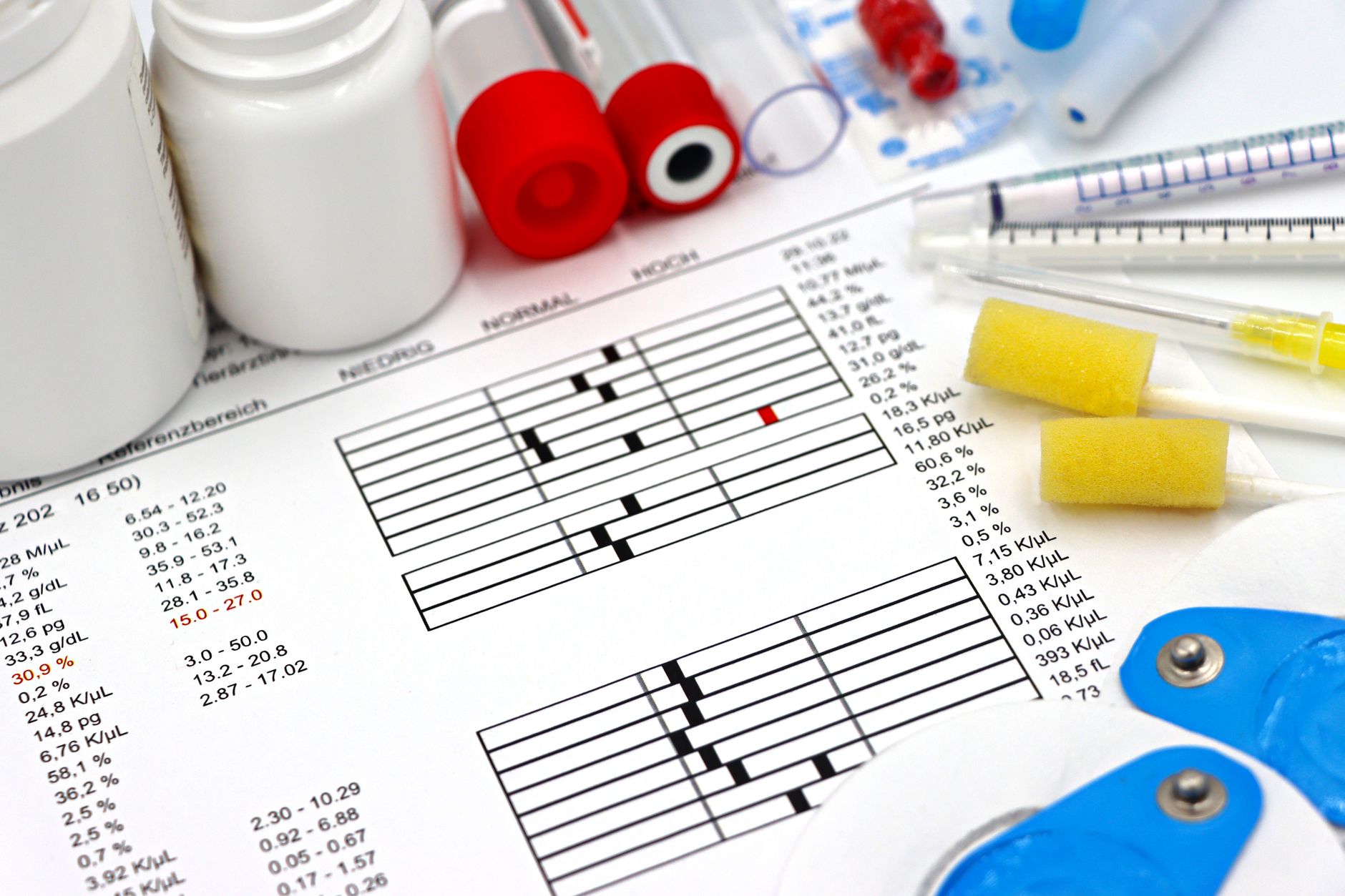 What is a Stress Test, and What is the Purpose of a Stress Test?