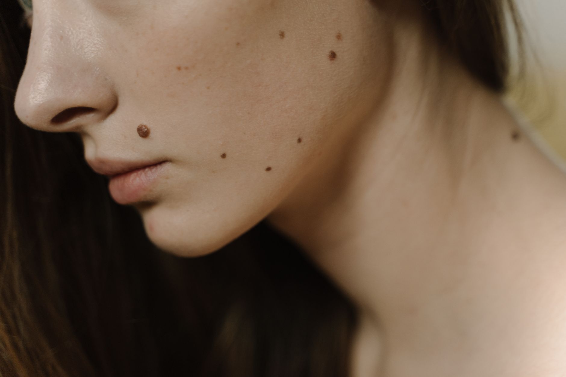 Myths and Misconceptions About Dermatology