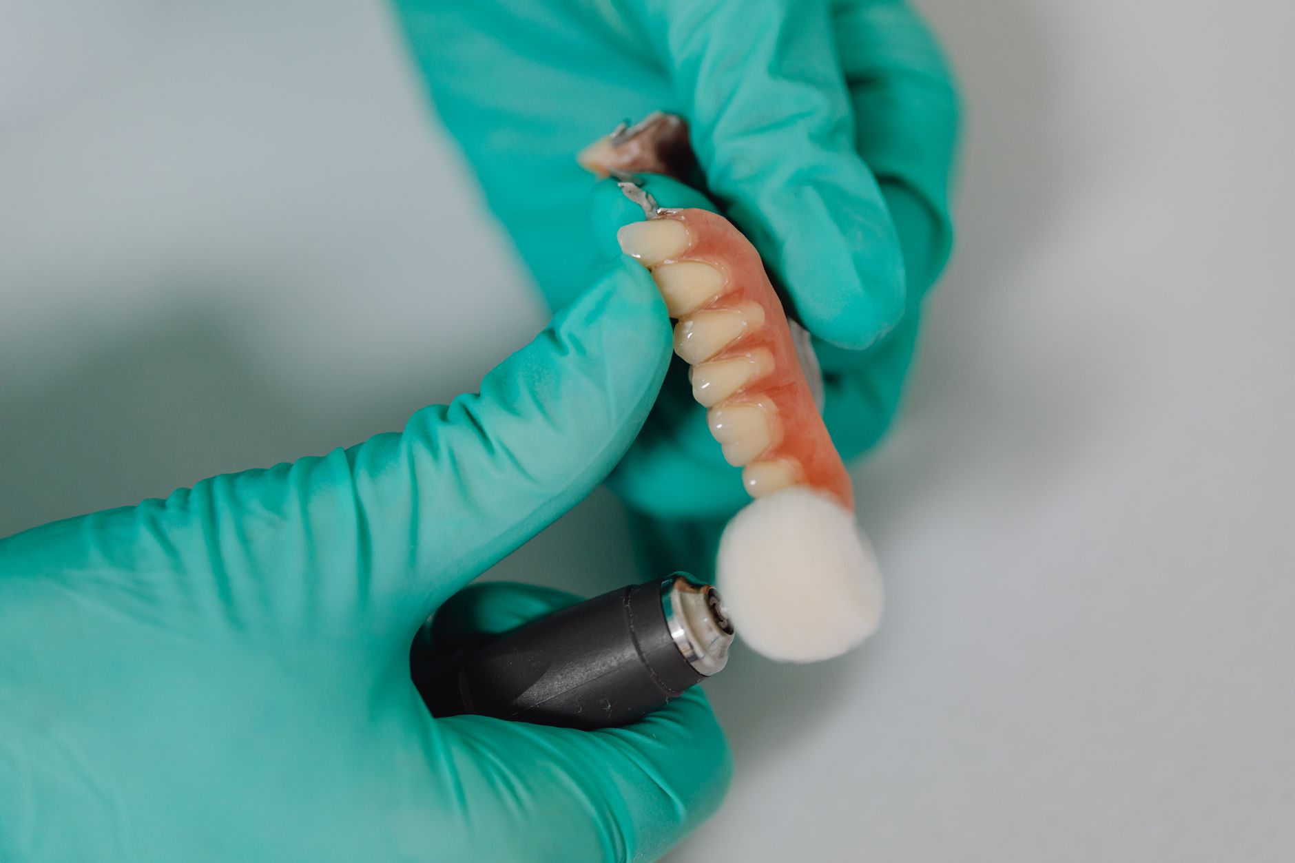 What Steps Are Involved in Dental Implant Surgery?