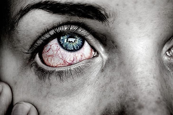 Mastering Dry Eye: Causes, Relief, and Long-Term Management