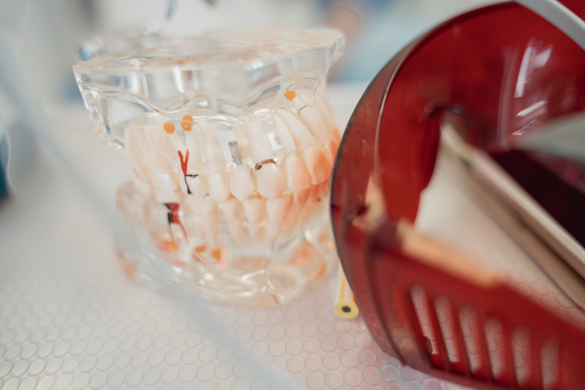 How does tooth implant really work?