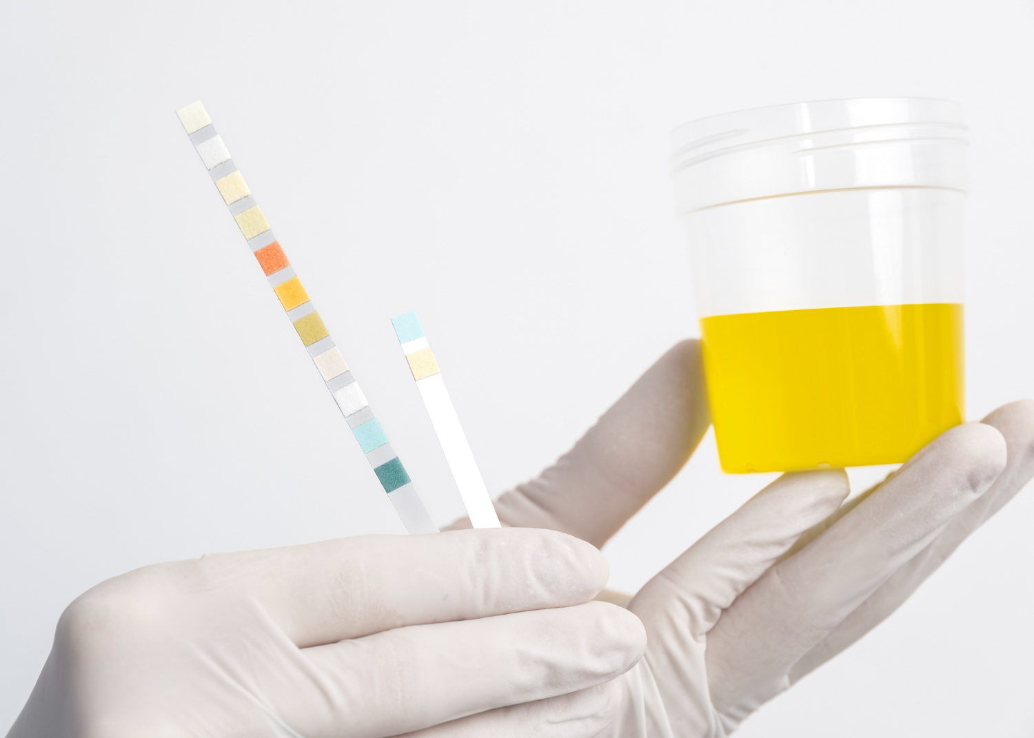 Introduction to At-Home UTI Self-Test Kits