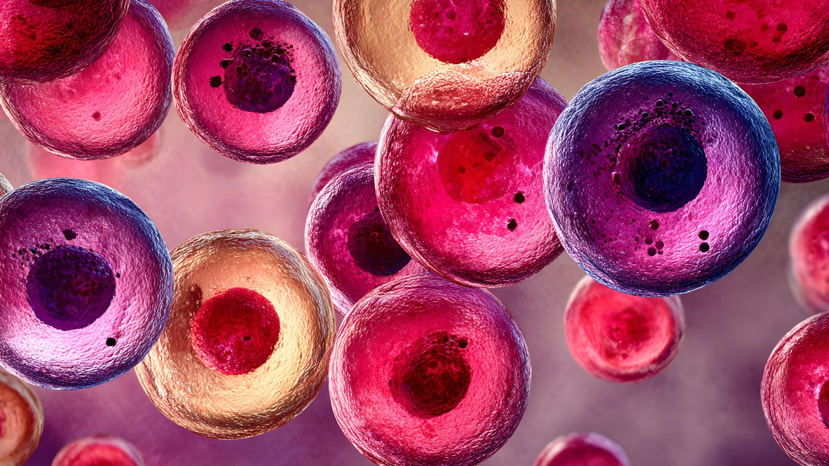 Menin inhibitors show promise in AML treatment Menin inhibitors show promise in AML treatment - menin inhibitors