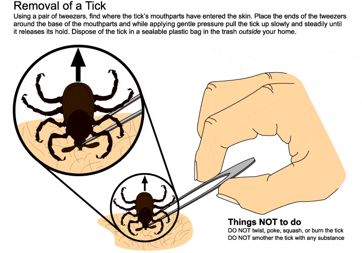 Tick removal