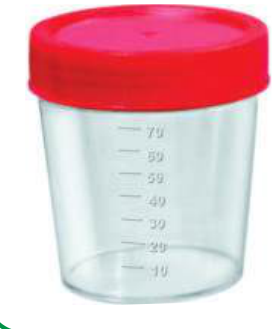 COLETOR URINA 70ML ESTERIL TAMPA VERM C/ROSCA S/PA 03260