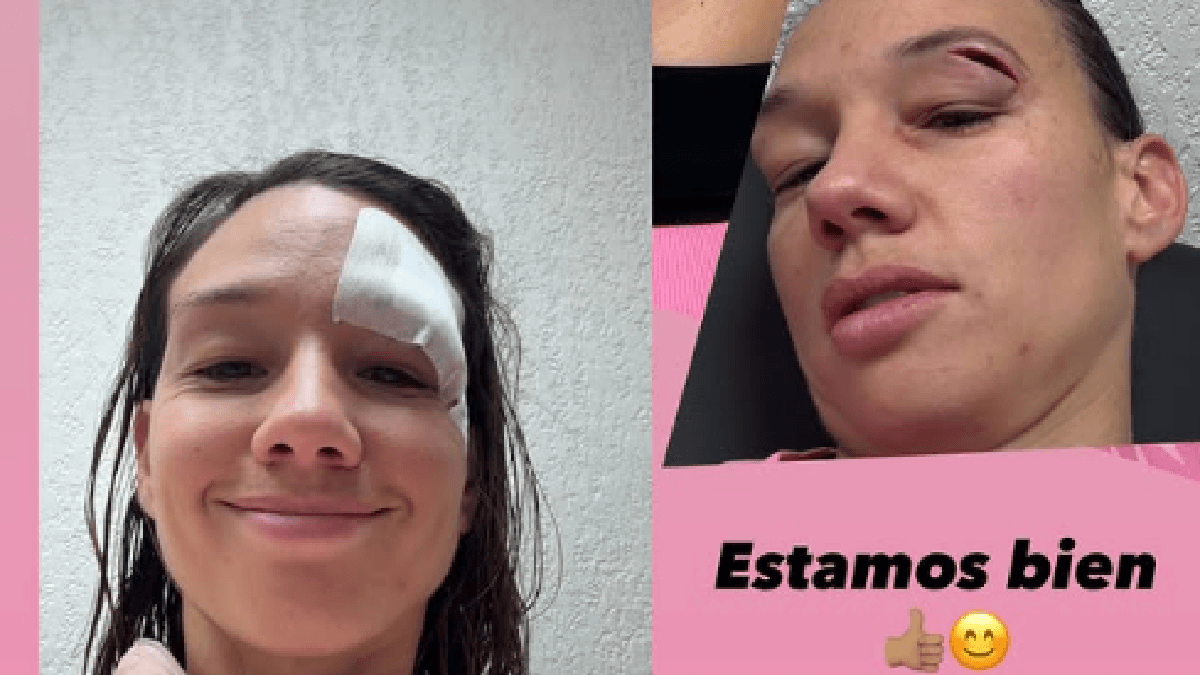 Christiane Endler Recibe Puntos de Sutura Tras Lesión en Partido