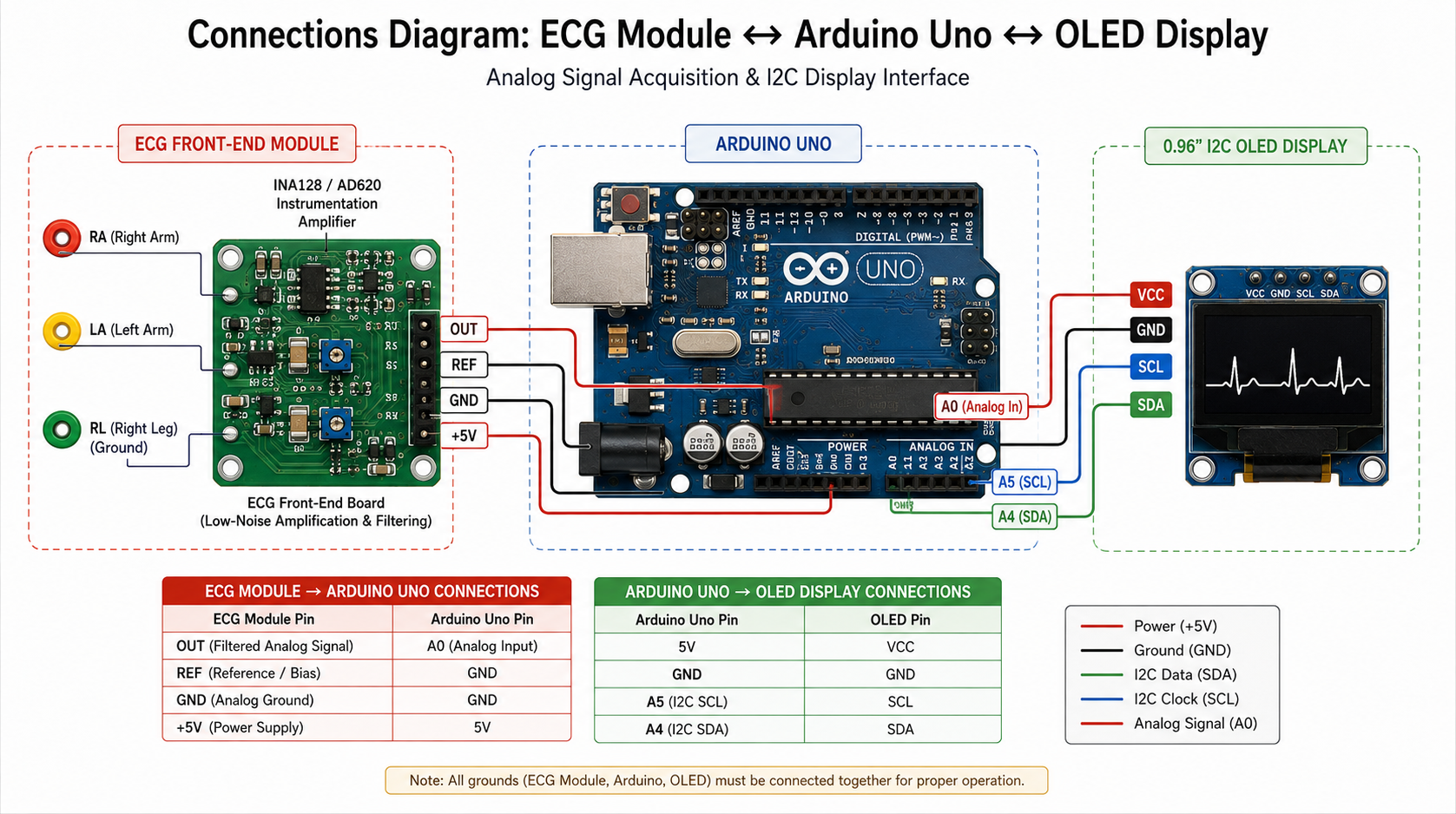 ECG Front-End Design: Low-Noise Amplification & Signal Acquisition