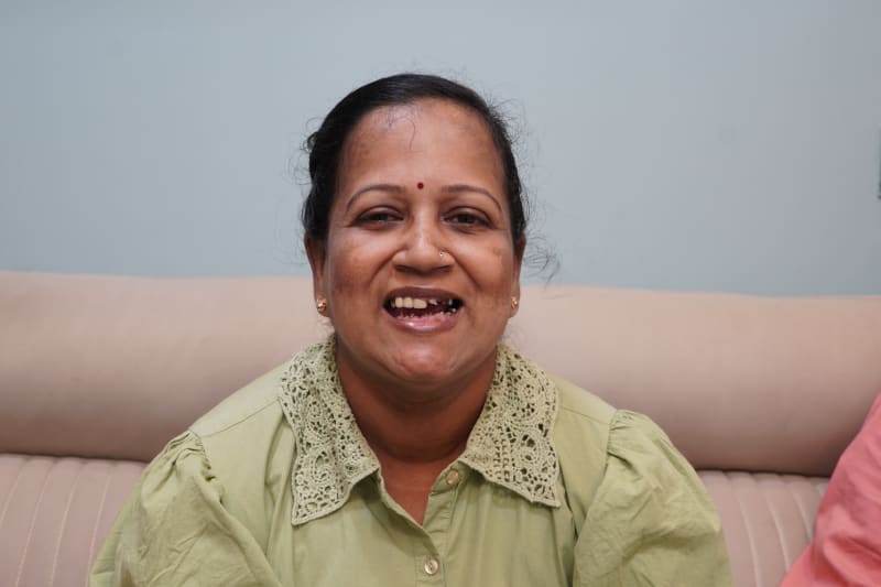 missing teeth broken teeth female patient before dental implants pune