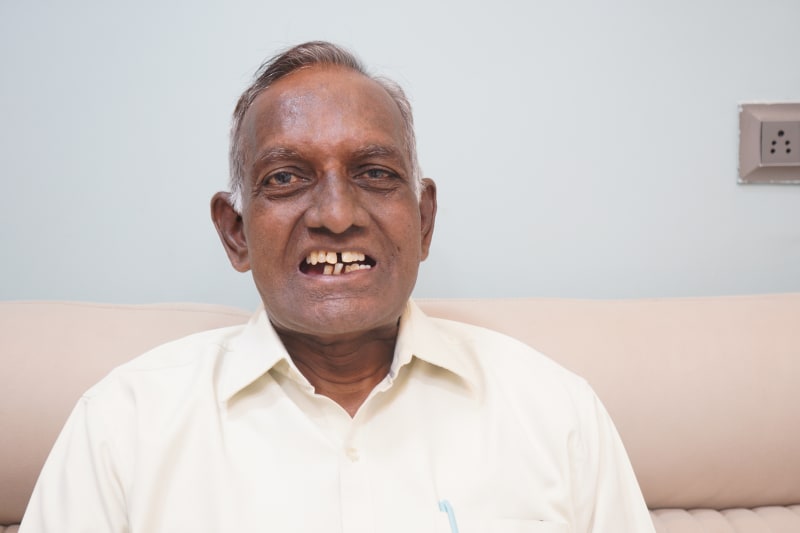 missing teeth elderly male patient before dental implants india