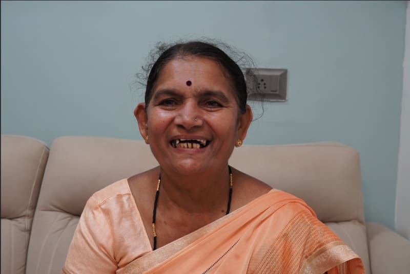 female patient Pune before full mouth dental implants missing teeth