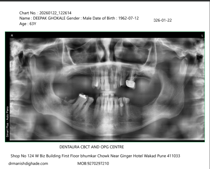 Deepak Gokhale X-ray before treatment