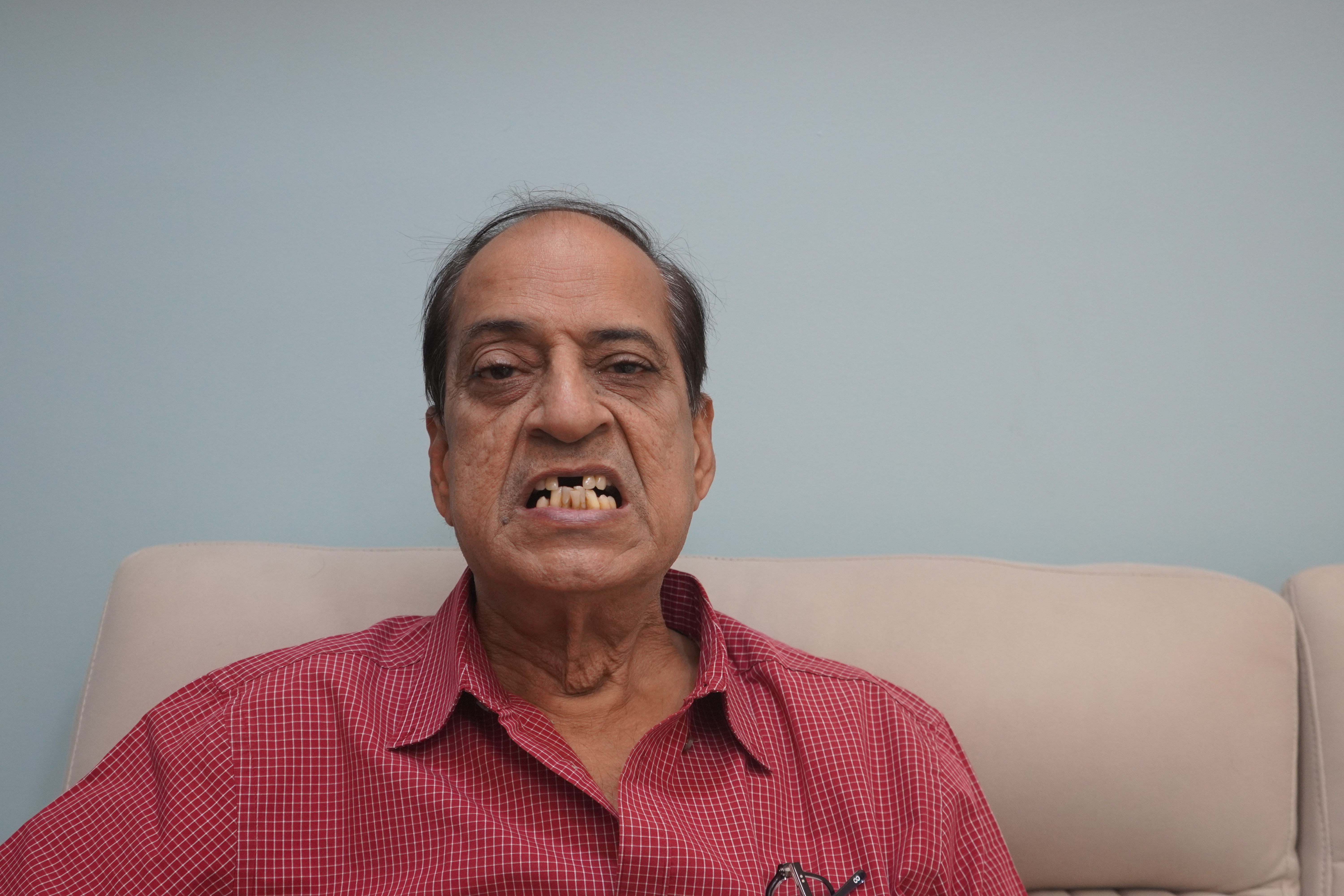 Ashok Gaba before treatment photo 1