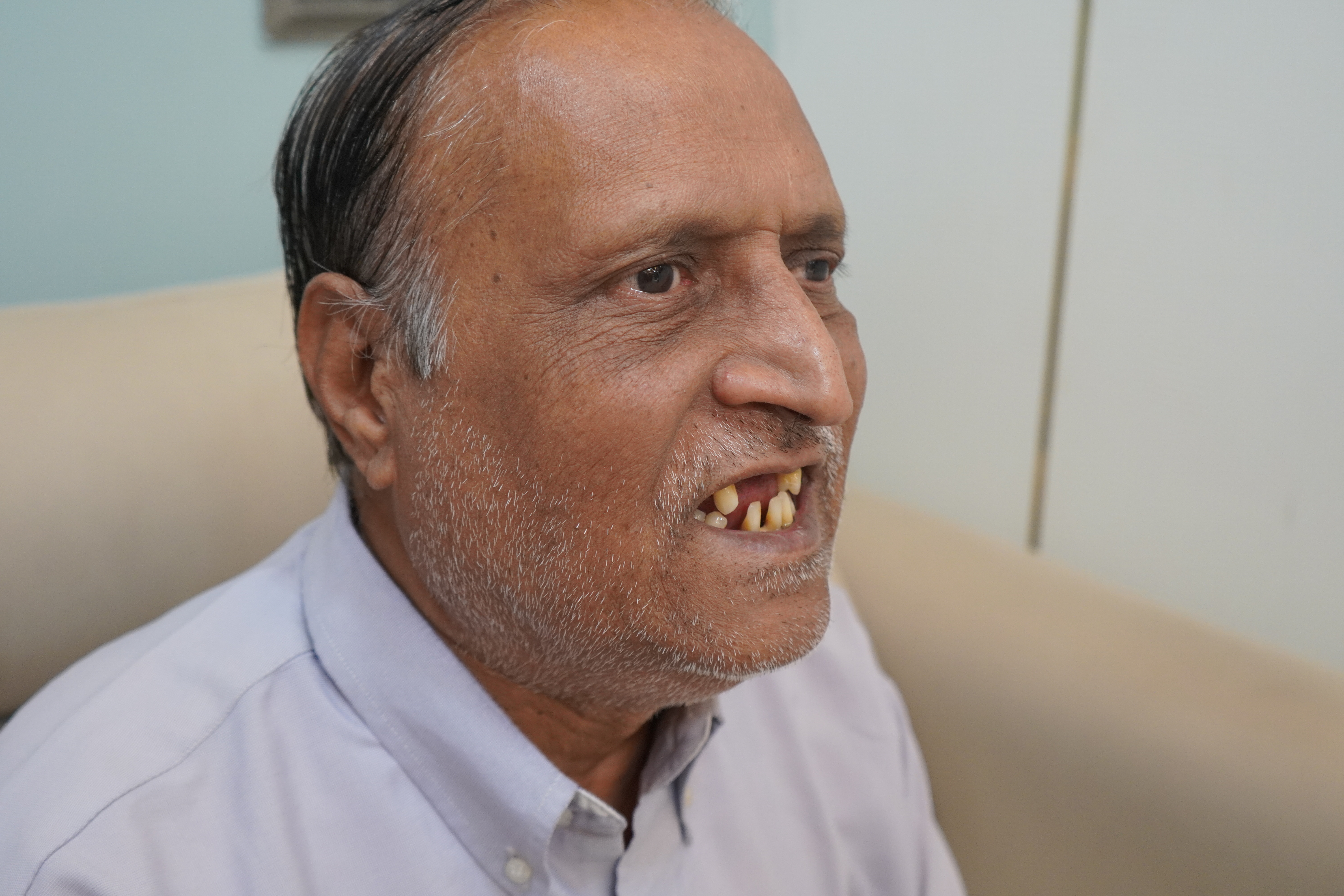 Madanlal Pardesi before treatment photo 2