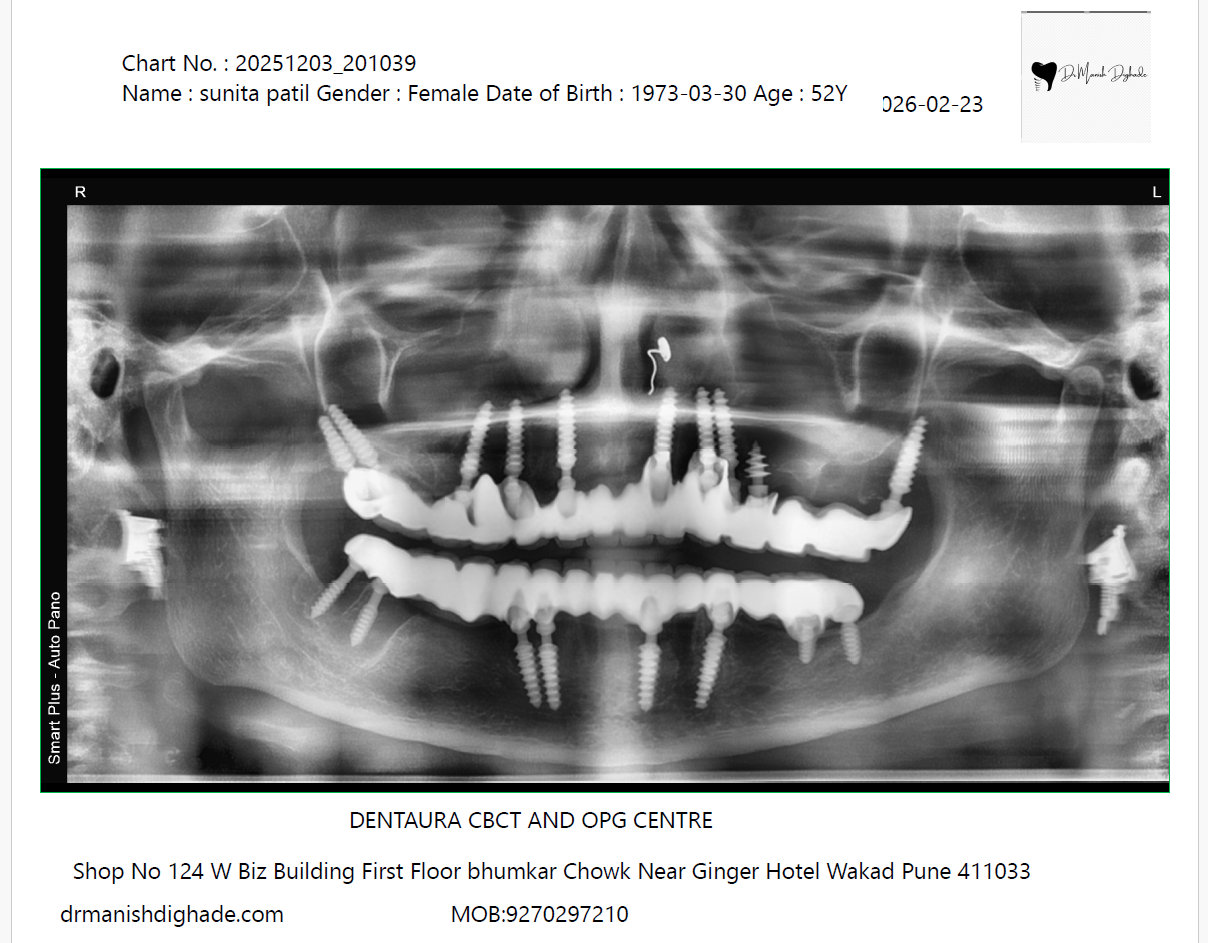 Sunita Patil X-ray after treatment