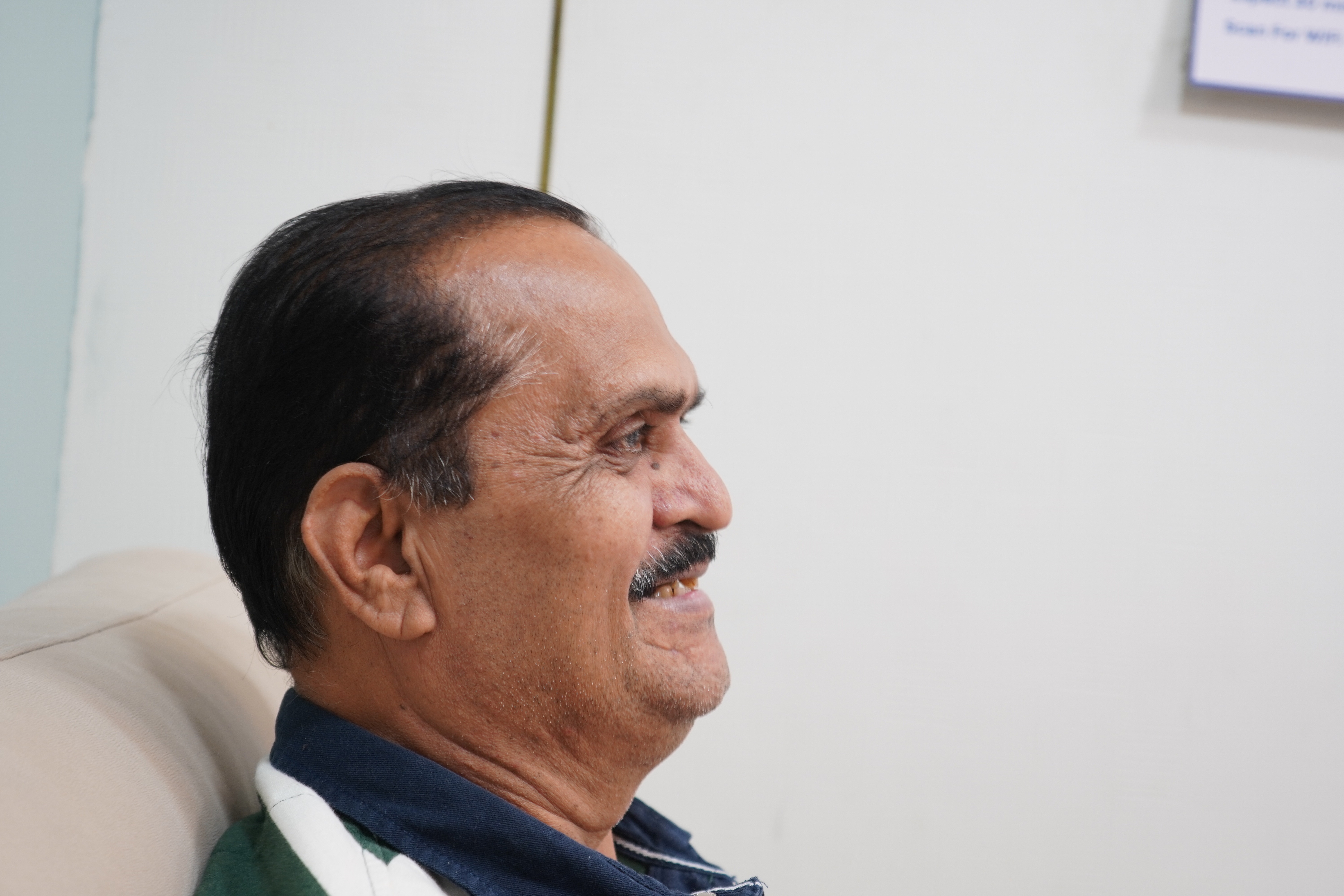 Before full mouth dental implants patient Pune difficulty chewing