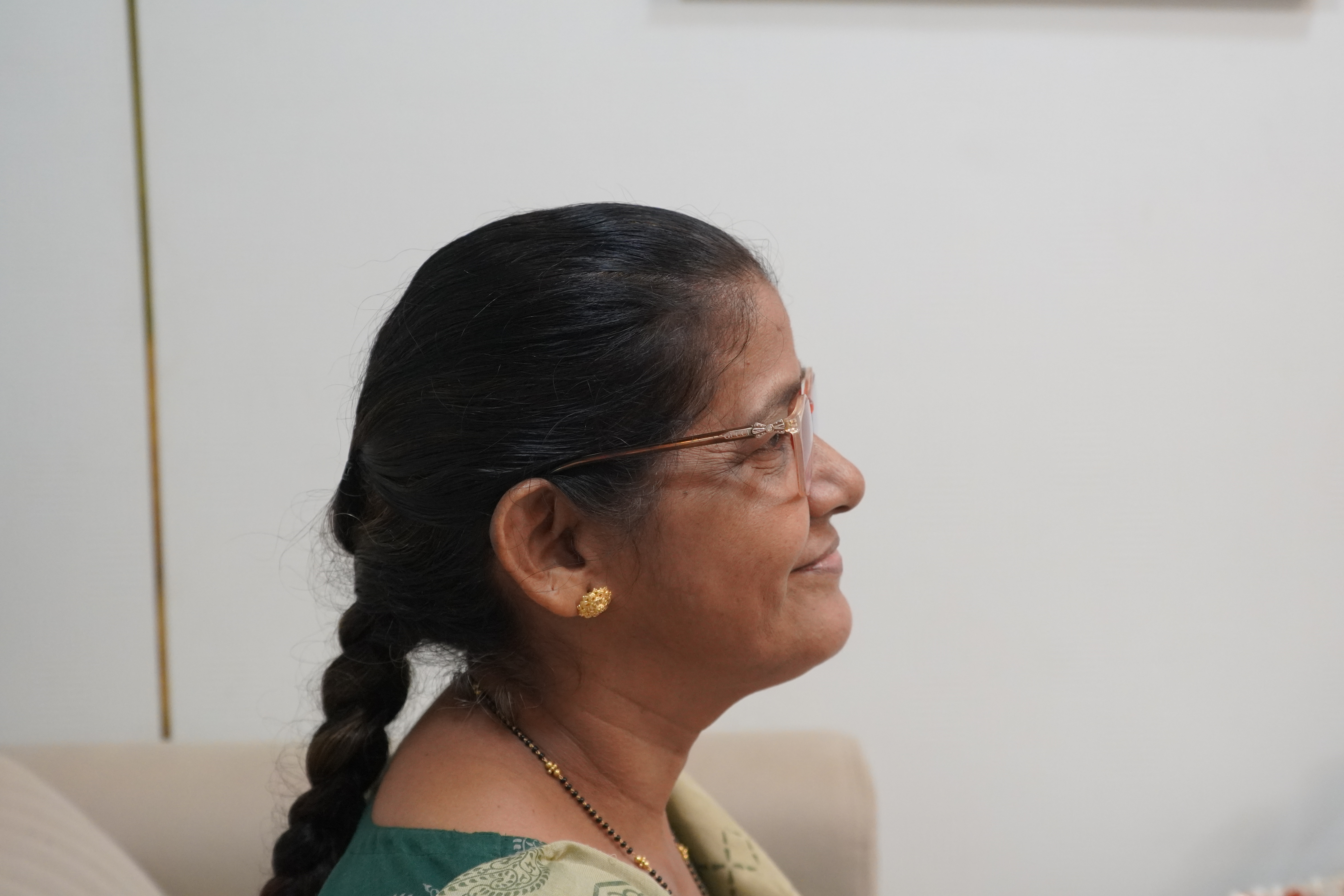 Before full mouth dental implants female patient Sindhudurg missing teeth