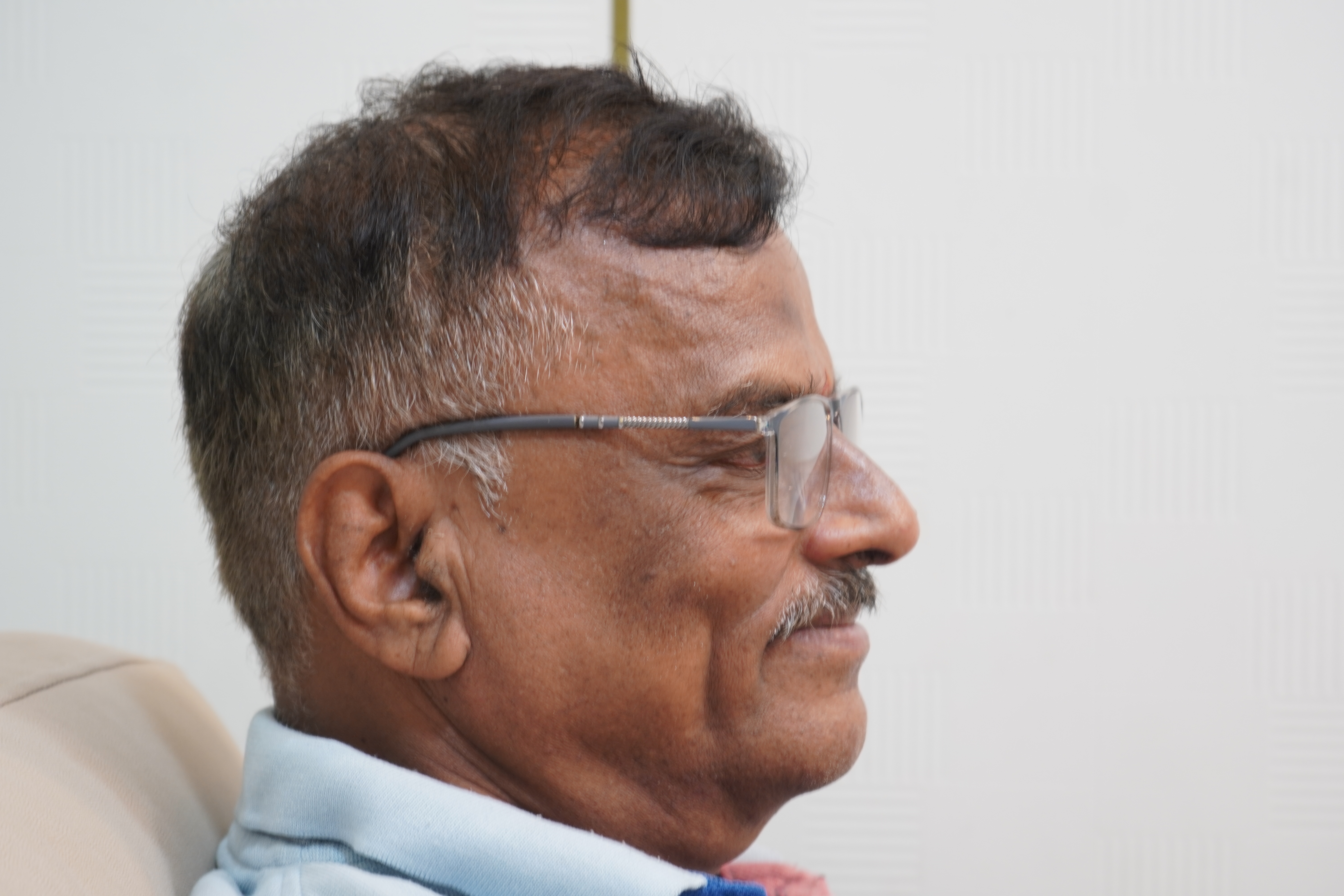 Sujan Shirodkar before treatment photo 1