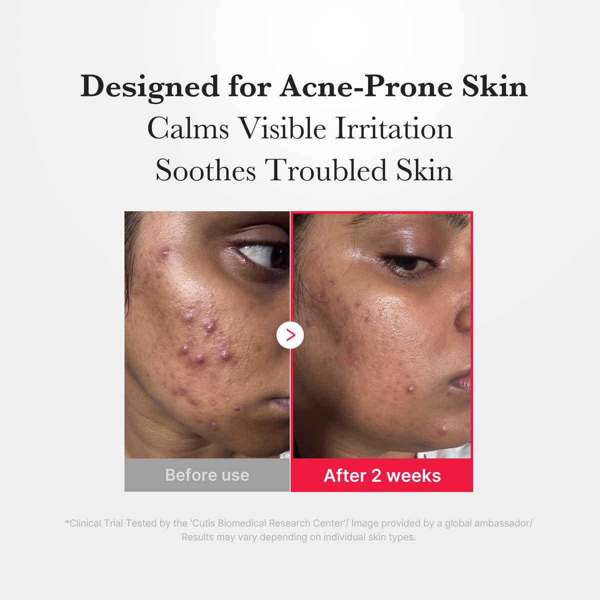 Заспокійливий спрей з хлорноватистою кислотою 5