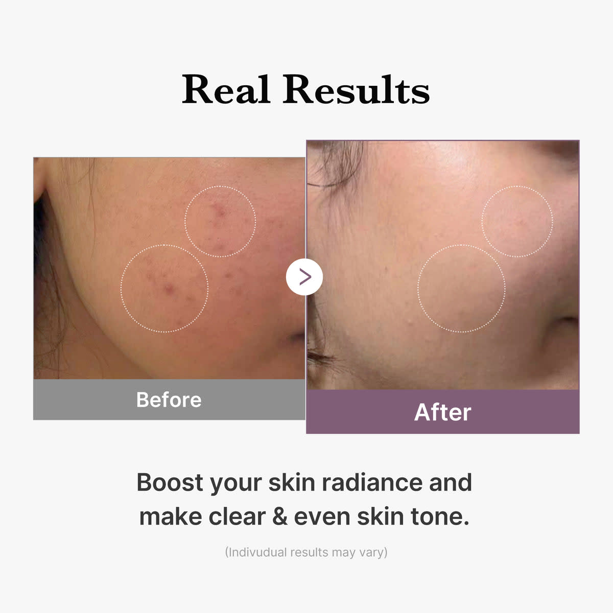 AGE-R Glutathione Glow Milk Тонер 5