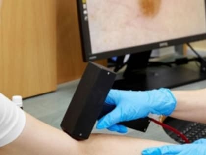 Признаки рака кожи, на которые стоит обратить внимание